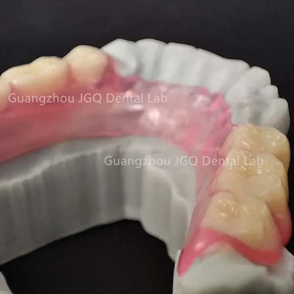 Customized Dental Crown and Implant with CE FDA Certification Using 3D Laser Printing Technology