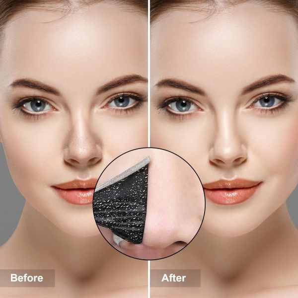 Blackhead Remover Strips Sticker Peel Off Pore Strips Sheet All Skin Types 3.9x9cm