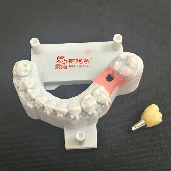 Dental Implants Custom Titanium Abutment Corrosion Resistant FDA Certification