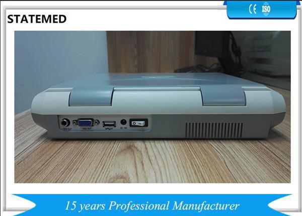 Pregnancy Portable Ultrasound Equipment / Laptop Ultrasound Scanner USB Port