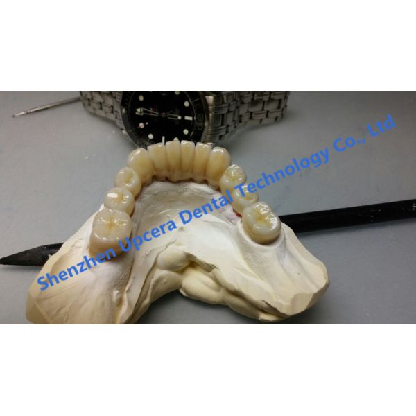 Ceramic Porcelain Blanks for Dental CADCAM Milling Zirkonia Blok Dental