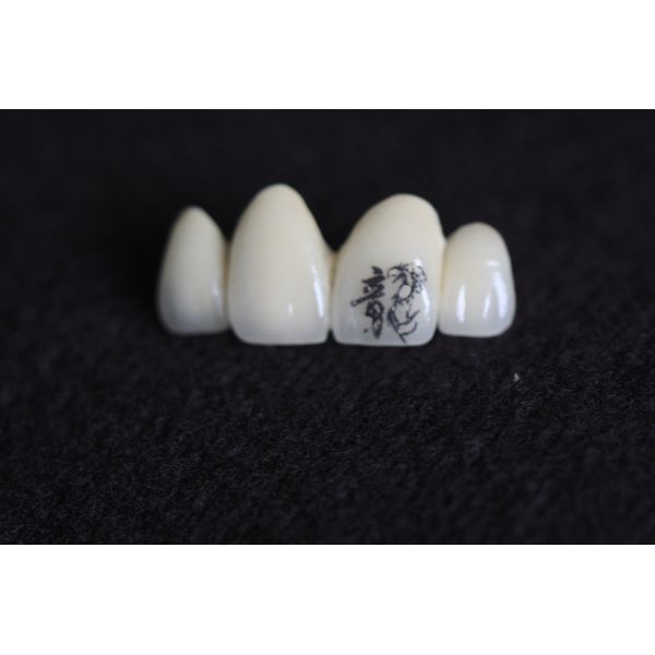 PFM Dental Crown Image Customization with personalized customized patterns