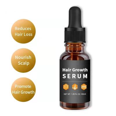 Anti Loss And Hair Regrowth Hair Oil Treatment With Natural Ginger Extract 30ml Customized