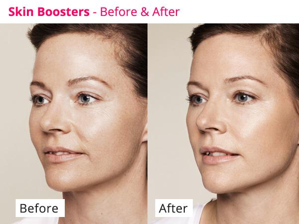 Hyamely Skin Regeneration Stimulate Collagen PDRN Serum Transparent Liquid