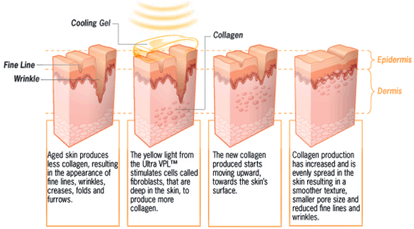 Mutifunctional Ipl OPT SHR Hair Removal Machine Beauty Salon With AFT Technology