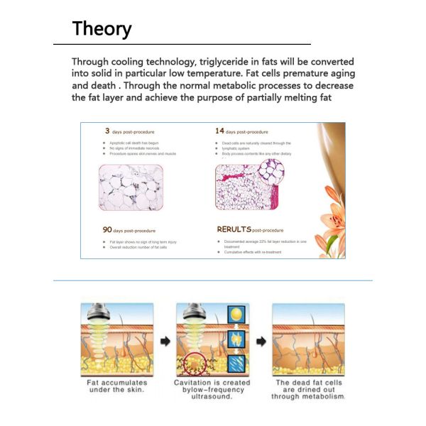home use portable cryolipolysis device/cryolipolysis machine/cryolipolysis fat reduce machine LF-213