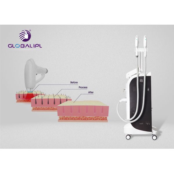 690nm Painless E Light 4000W OPT Shr Laser Machine