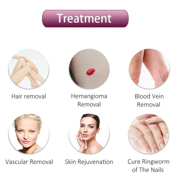 1064 нм длинный импульс Nd Yag лазерная машина сосудистое удаление постоянное удаление волос