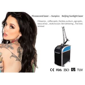 Picosecond Laser Tattoo Removal Machine