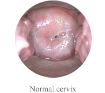 Видеокамера камеры Cervix для влагалищной Handheld собственной личности Colposcope цифров миниой - осмотра с увеличением 1,5 времен
