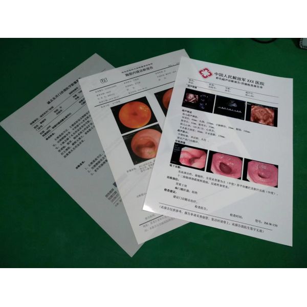 204±8 μM Толщина медицинской сухой пленки с высокой долговечностью ≤ 20% Ультрафиолетовой устойчивости к туману