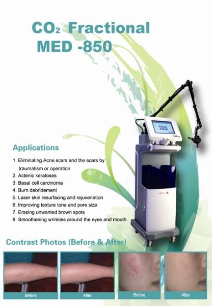 RF Tube Co2 Fractional Laser Technology Beauty Machine for Acne Scar Removal