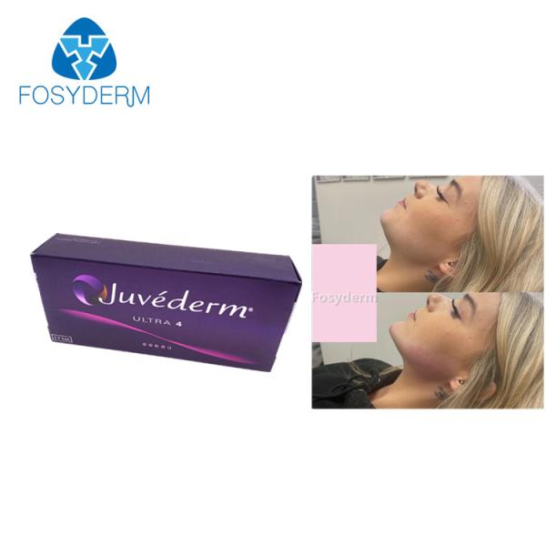 Realce ácido hialurónico do bordo dos enchimentos de Juvederm 2ml