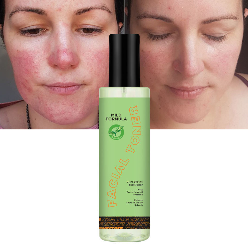 OEM ODM brand organic pure toner Sensitive skin care product Anti redness, anti allergy, moisturizing facial toner spray soothing agent