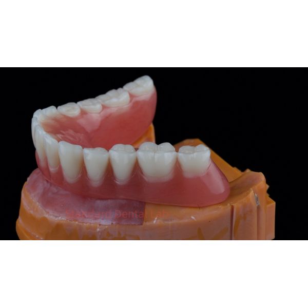 Ivoclar Digital Dental Implant Bar Denture with Attachments Full Acrylic Denture Titanium Implant Supported Dentures