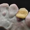 China Dental Artificial Teeth Pfm Dental Metal Ceramic Crown Bridge Customized