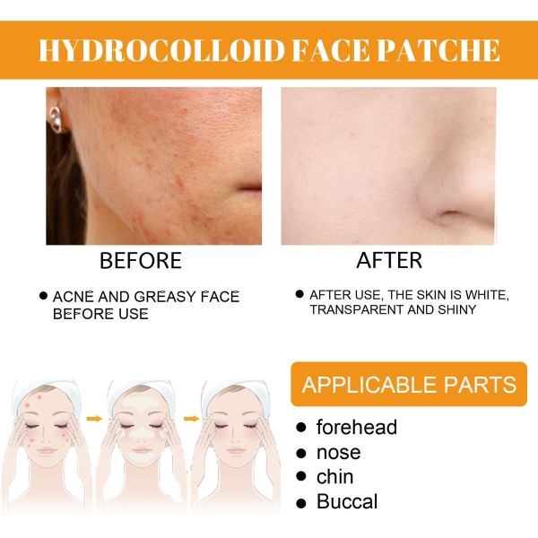 OEM Private Label Hydrocolloid Acne Patch For Spot Treatment Pore Cleaner