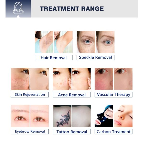 AS20 Professional Nd Yag OPT Beauty Machine Laser for salon OEM Pigment hair tattoo Removal device women carbon peeling