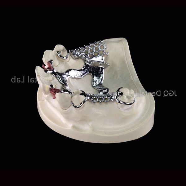 3D Printing Co Cr Alloy Removable Denture Framework Customized for Oral