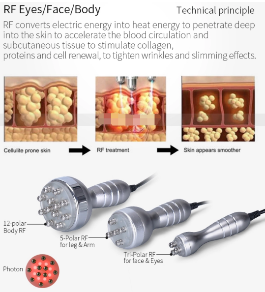 Вакуумная кавитационная машина 40k Rf Лифтинг лица Кавитационная машина для затягивания кожи
