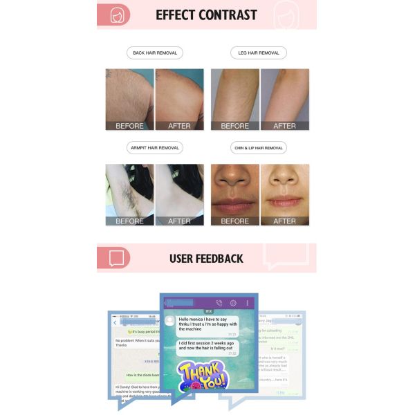 удаление татуировки машины не инвазионной брови лазера диода 808nm очищая