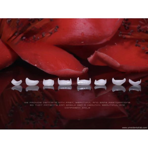 Zirconia Ceramic Veneer Natural White