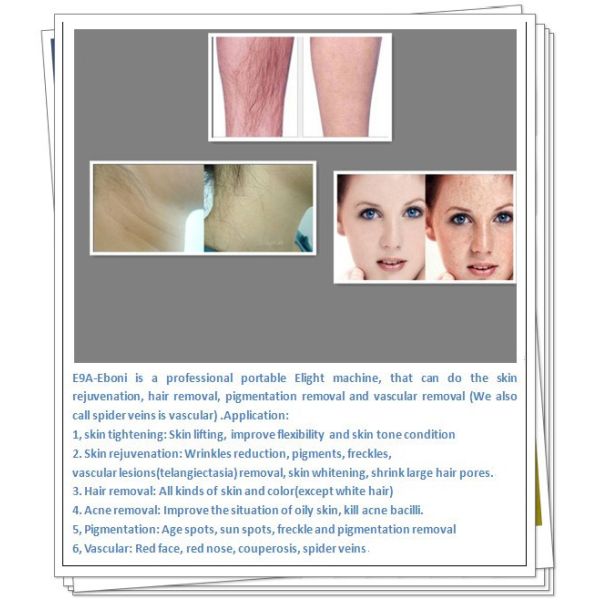 IPL RF Touch Screen Hair Removal Beauty Equipment ELight Portable With Red Button