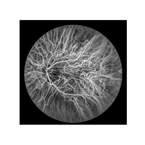 Equipo oftálmico de Angiograph Digital 160° de la retina