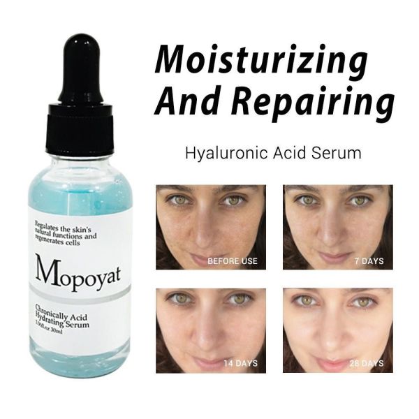 Mopoyat hyaluronic Acid Serum