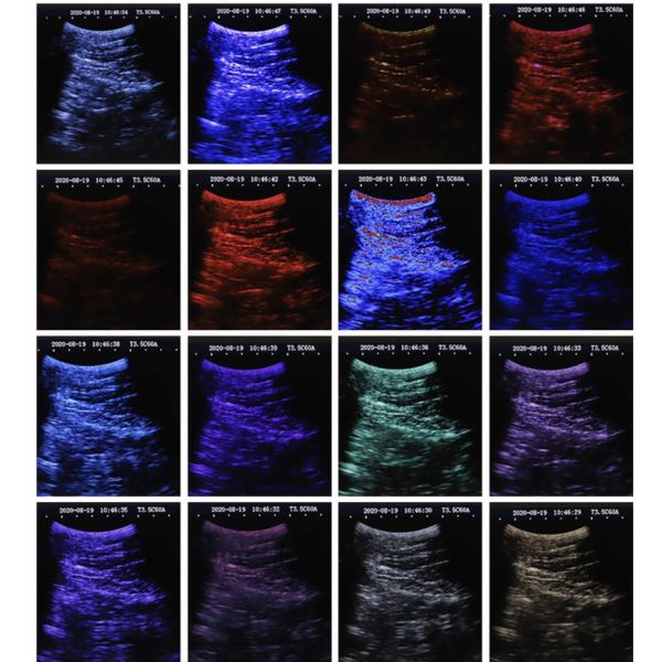 B 5.7 Inch Veterinary Ultrasound Portable Animal Enclosure Handheld Digital Veterinary Ultrasound Machines Veterinary Ultrasound Scanner