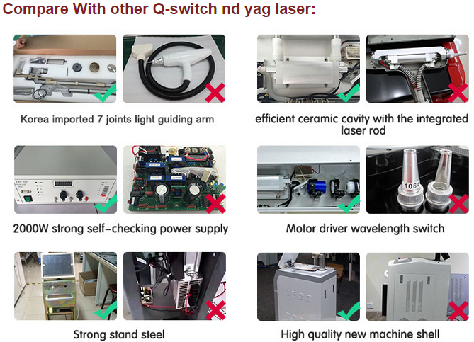 La venta caliente 1064nm / 532nm Q cambió el equipo de la belleza del retiro del tatuaje del laser del yag del nd