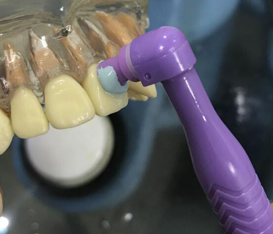 Plastic Disposable Prophy Angle With Brush Snap On Soft Buckle Ribbed Cup Head Green