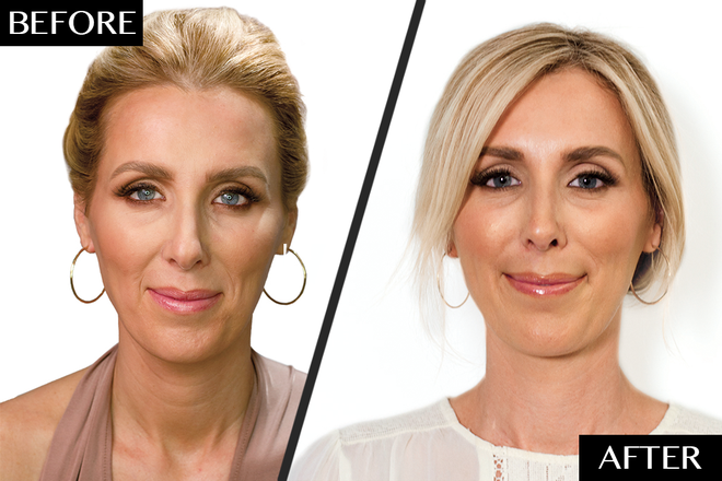 HA Eyebrow Lines Neuramis Увеличение губ с гиалуроновой кислотой 1 мл Формирование губ