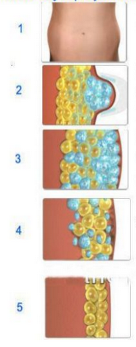 US08A Vacuum fat roller Massage rf slimming machine , fat melting machine