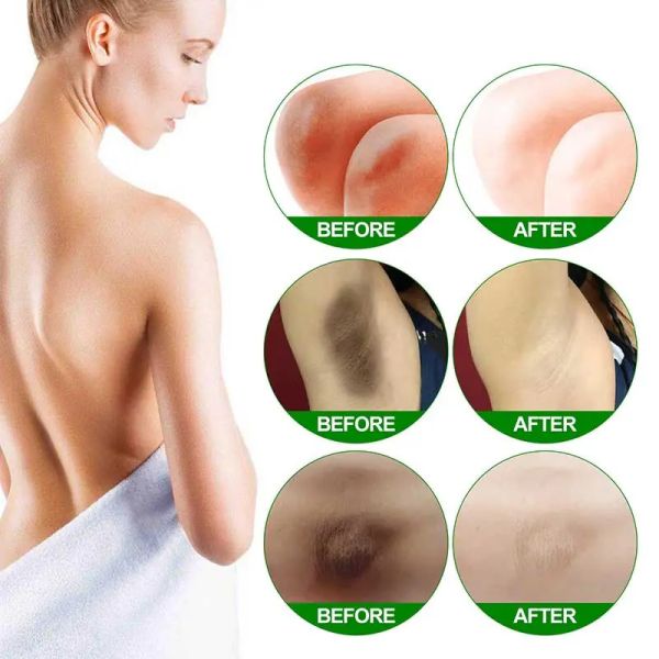 Крем для отбеливания тела Серум для отбеливания Удаления меланин пигментации Осветление внутренней части бедра Увлажняющий крем для кожи