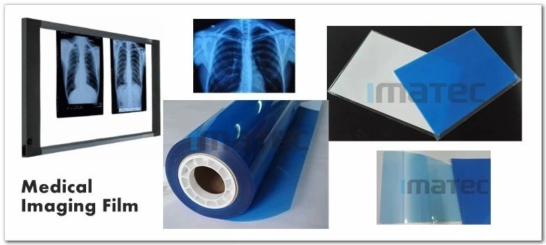 Медицинская рентгеновская сухая пленка медицинская рентгеновская струйная пленка с четким качеством изображения