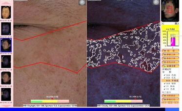 Fashion Magic mirror skin testing system to any skin type for beauty salons or clinic