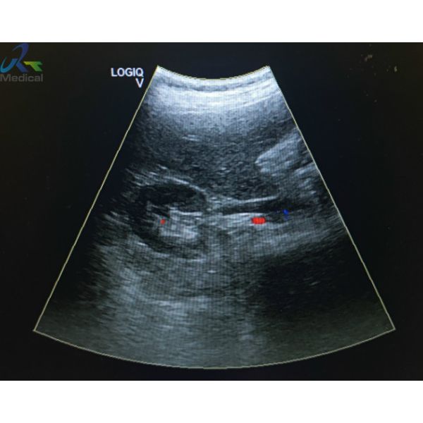 GE 4C-RS Curved Array Abdominal Ultrasound Probe Hospital Instrument