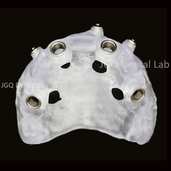 Dental Lab Customized Surgical Guide For Dental Implants 3D Laser Printing