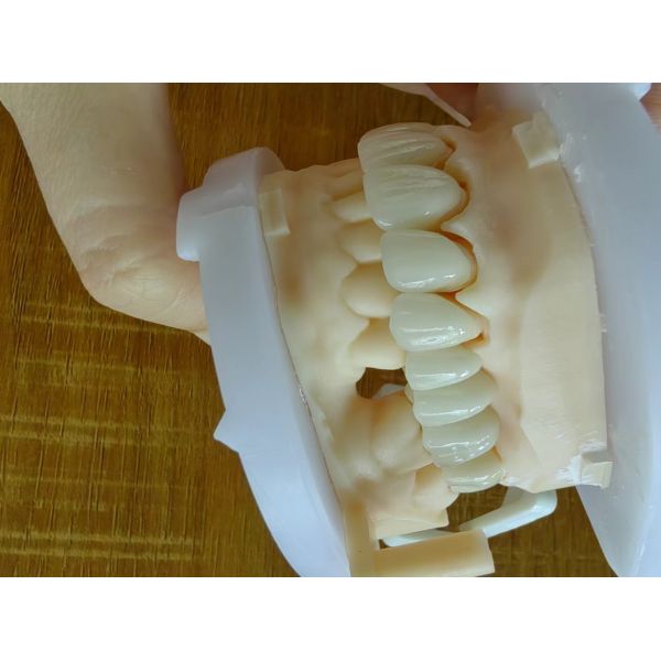 Estética Restauración dental de zirconia Coronas de porcelana de zirconia