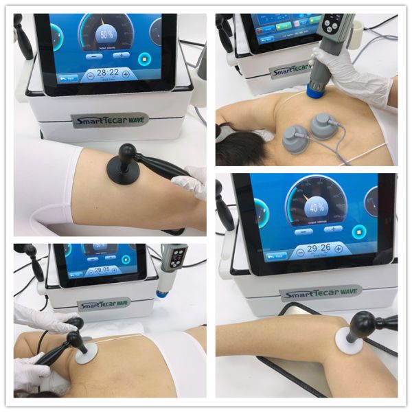 448Khz Tecar Therapy Machine / RET CET RF Machine для ухода за телом