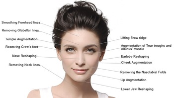 заполнитель Хялуроник кислоты 1.0мл лицевой, гель Хялуроник кислоты впрыски для стороны