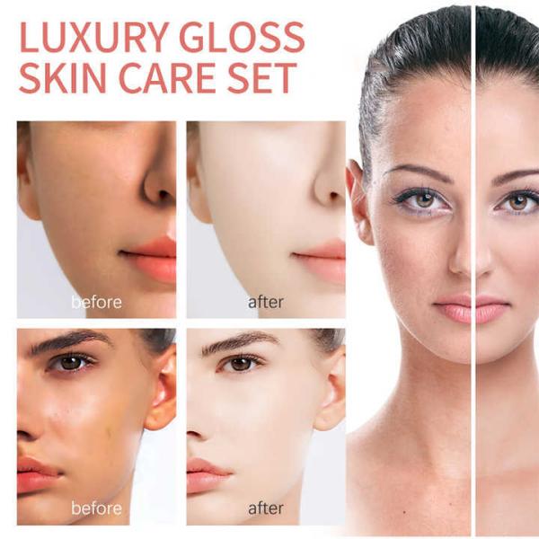 Productos para la piel de combinación sensibles a medida Limpiezas para poros Productos cosméticos