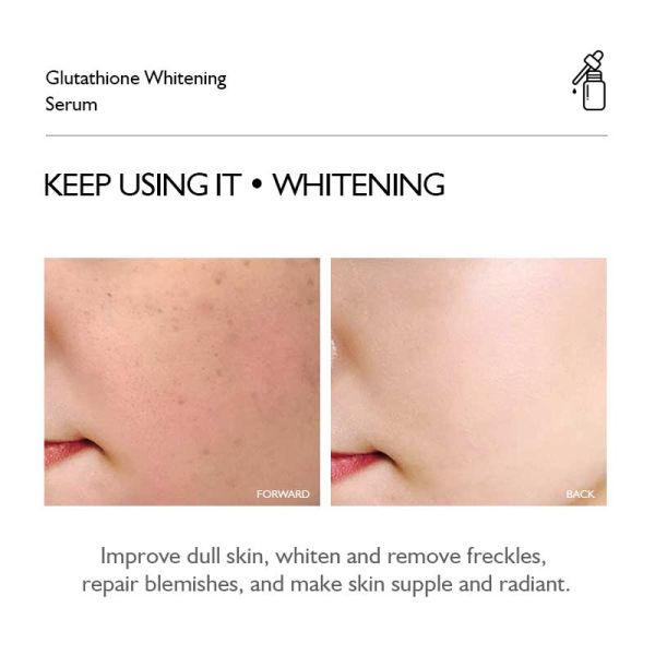 Сыворотка для лица с экстрактом глутатиона для ухода за кожей, отбеливающая антивозрастная сыворотка для лица с веснушками