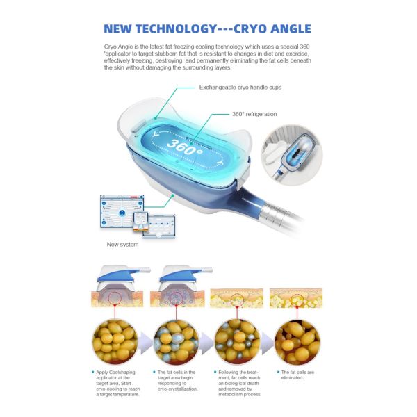 Productos que tienden superiores 2022 360 máquinas de Cryolipolyse Cryotherapy/máquina Cryolipolysis de Criolipolisis