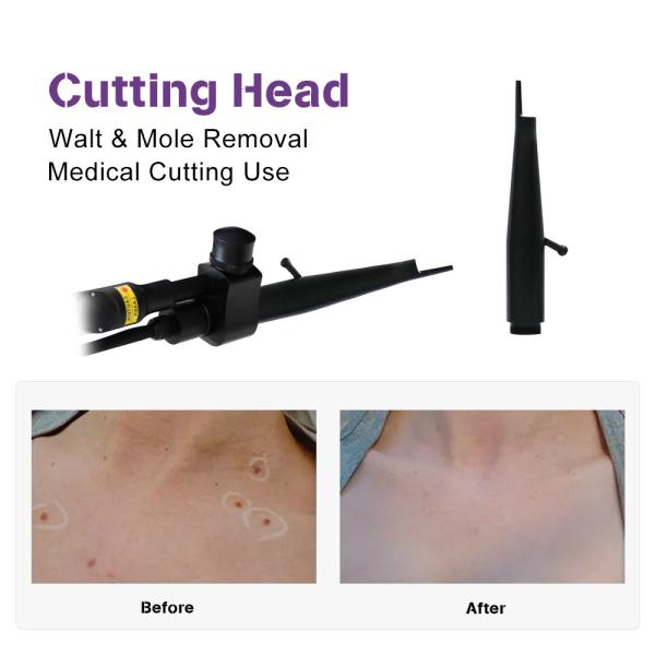 Salon Clinic 10600nm Acne Scar Removal Vaginal Tightening Cosmetic Surgery Co2 Skin Resurfacing Laser Machine