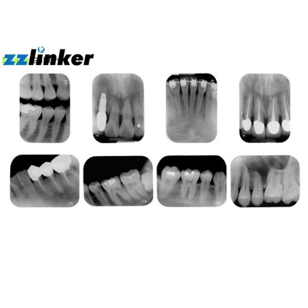 Мобильная зубоврачебная машина кс Рэй, отображать зубов телевизионного кинопередатчика кс Рэй Апикся ПСП зубоврачебный