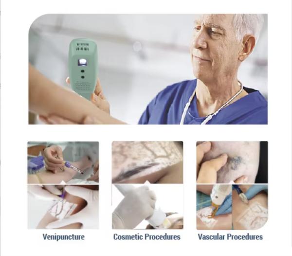 Dispositivo de localización de venas portátil verde 850nm para clínicas médicas y belleza