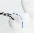 Medical Gauze Balls 100% Bleached Cotton 100 Pcs/Pack ce certification