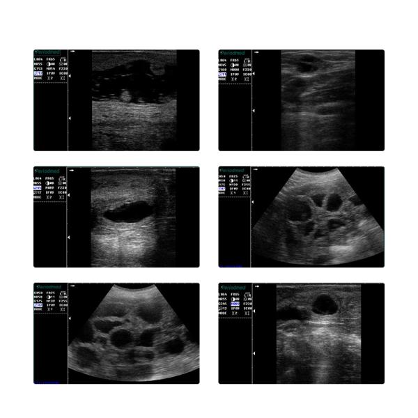 Yonker Veterinary Ultrasound Pregnancy Ultrasound Scanner for Animal Dog Vet Portable Digital Ultrasound